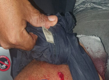 Policial Militar é baleado por invasores de terra em distrito de Porto Velho