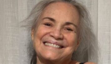 Aos 79 anos, Regina Duarte aposta em tratamento natural feito em casa para combater a calvície